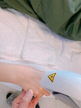 ウェリナ(welina)/脱毛