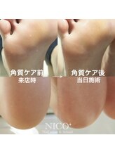 ニコプラス(NICO+)/足裏の乾燥や角質が気になる方へ