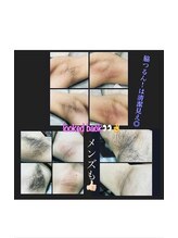 ステラマリス(STELLA MARIS)/この夏開始！脇脱毛でスッキリ♪