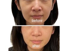 ジーニー(Genie)/「整えヘッド&ハイパー」