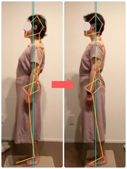 ラクリエ 東加古川院(La Creer)/お客様ビフォーアフター