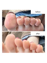 ネイルアトリエ ボン(nail atelier bon)/足裏角質ケア