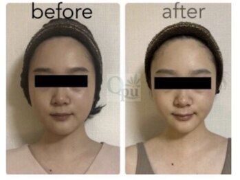 キュープ 名張店(Qpu)/初回から半年後の変化!