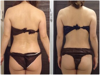 美容整体ウェリナ 名駅院/小顔矯正/骨盤矯正/美脚サロン