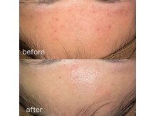 ヴェリス 新宿店(Velisse)の雰囲気(ニキビケア/毛穴/乾燥/エイジングケア/美白/シミしわケアが叶う!)