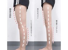 スタジオ ベガ(Studio vega)の雰囲気(下半身太りのタイプを見極め、施術を組み立てて行きます。)