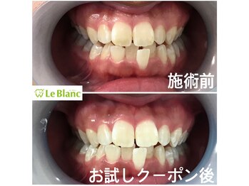 ルブラン 奈良店(Le Blanc)/ホワイトスポットは