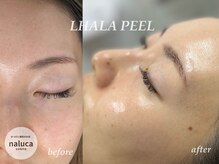 ナルカ(naluca)/【堺市・中百舌鳥】ララピール