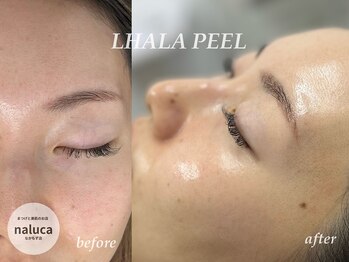 ナルカ(naluca)/【堺市・中百舌鳥】ララピール