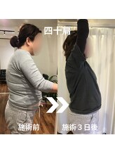 からだサロン サニー 堺東(SUNNY)/肩の痛み