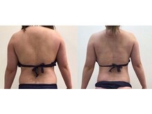 ニカ(NIKA)の雰囲気（最強痩身マシン3stepは効果絶大）