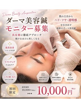 リベルテ(liberte)の写真/【高価なスキンケア】では物足りない方必見！真皮層の数千の創傷治癒を使う肌質改善ダーマ美容鍼10000円★