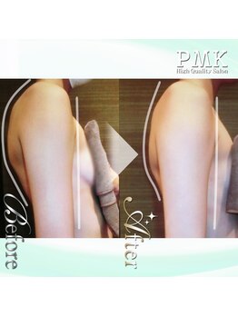 PMK 新宿店/造形パワーツリーコース1回施術