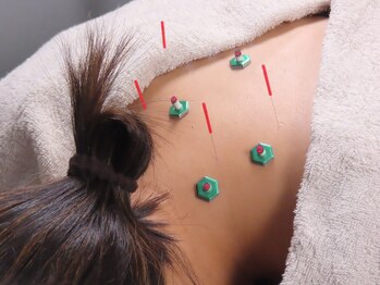 かなざわ鍼灸院/