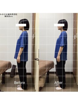 わきさか鍼灸整骨院・鍼灸院 レーヴ(Reve)/産後ママにも!優しい骨盤矯正