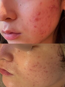 セレニテ(Serenite)/