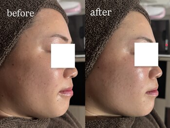 ビビ(Vivi)/赤みが消えトーンアップ♪