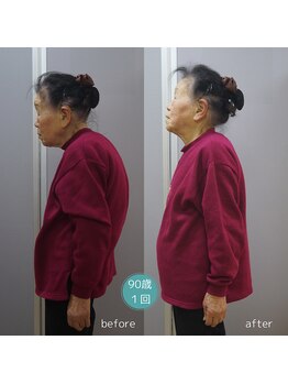 アップルミント/＜リンパ整体＞before・after