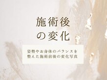 にこ。/整体による施術後の変化