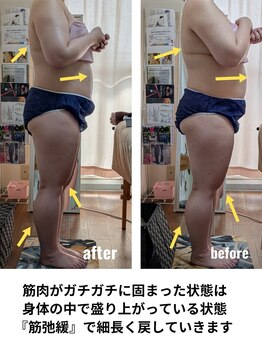 紬(TSUMUGI)の写真/楽しむ夏に！ゆるふわで肩首コリを根本解消！盛り上がって固まった筋肉を緩めて美姿勢、細見えも実現！