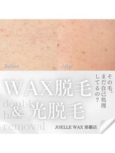 ジョエルワックス 沖縄那覇店(JOELLE WAX)/那覇市で人気WAX＋SHRダブル脱毛