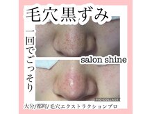 サロンシャイン(Salon Shine)