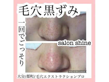 サロンシャイン(Salon Shine)の写真