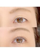 レッドモート(Red moat)/ダブルアイリフト