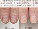 地爪育成コース【3ヵ月(全8回)】