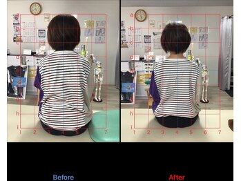 ストレチックス 近江八幡店/BeforeAfter