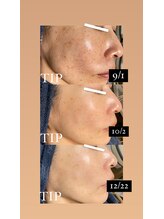 ソリッジ肌管理室/シミケアおまかせください