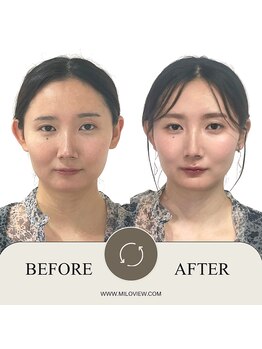 ミラビュー(MILOVIEW)/ウェディング診断＆黄金比メイク