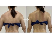 ハクカスパ(HAKUKA SPA)の雰囲気（本格肩甲骨剥がし!!もっこり肩、巻き肩、姿勢改善☆）