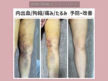 コネクト
