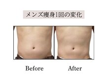 ソウ 明大前(SOU)の雰囲気（男性施術者常駐！メンズのダイエットもお任せください）