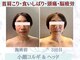 エンボディメントラボラトリー エイトレターズ(Embodiment Lab. 8 LETTERS)の写真