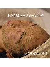 ココルーネ(COCORUNE)/シルク肌ハーブピーリング