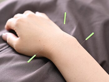 鍼灸院くろえ 大阪江坂/鍼灸◎