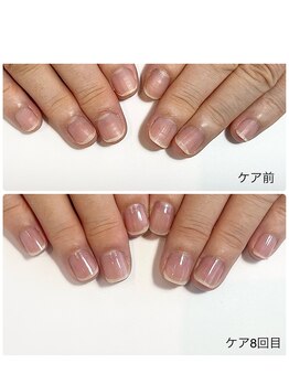 ルクレール カシェット(Le clair cachette)/美爪育成コース