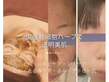 カラーリリー(calla lily)