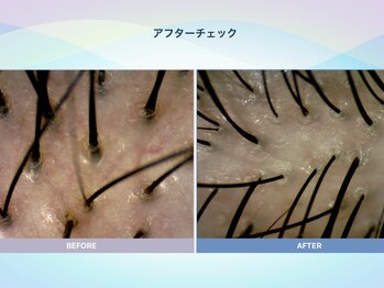 アンス(anth:)/お客様の仕上がり