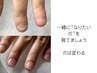 【ご新規さま限定】まずは相談のみ！深爪・爪のお悩み相談・お子様の爪相談◎