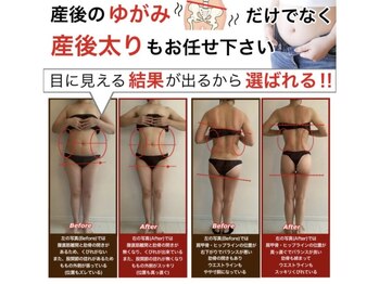 つのだ産前産後ケアサロン/子連れ/骨盤矯正/痩身/産後/腰痛