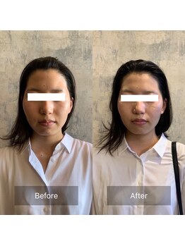 フフラ KANコルギセラピー山梨本店(fufla)/頭蓋骨小顔矯正【小顔ソムリエ】