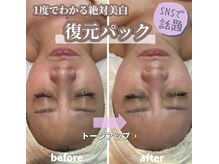サロン(SALON)/復元パック