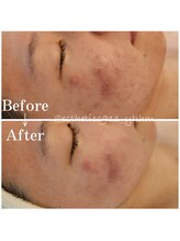 エステティックス ナインワンワン 横浜(Esthetics911) /フェイシャル1回施術で効果◎