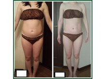 プライベートサロン 美月の雰囲気（【結果重視】様々からアプローチで立体的小顔&肌質改善へ！）
