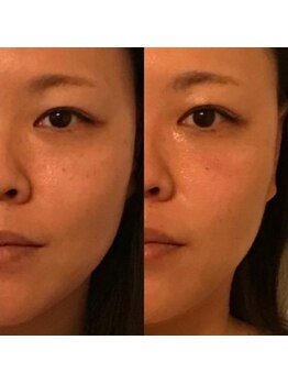 メジェール/ハーブトリートメント♪