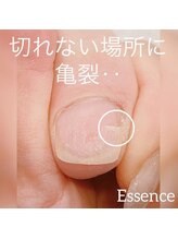 エッセンス (Essence)/お気軽にご相談ください◎