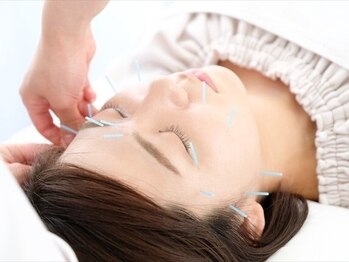 アクト 駒沢店(ACT)の写真/【美容鍼】リフトアップ/しわ/たるみケアにおすすめ♪内側から徹底的にアプローチし理想的なお肌へ導く